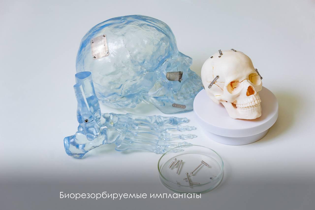 Фиксирующие и поддерживающие имплантаты, которые не требуется удалять