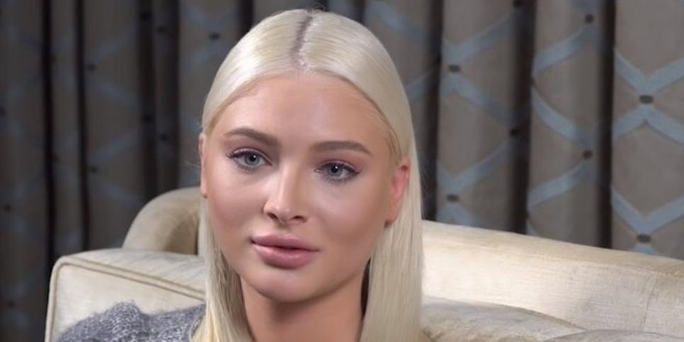 Виктория Боня заявила, что косметологи обезобразили Алену Шишкову из "Звезд в Африке": "Будьте осторожны с уколами"
