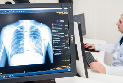 В Москве заработали два новых сервиса ИИ для рентгенологов